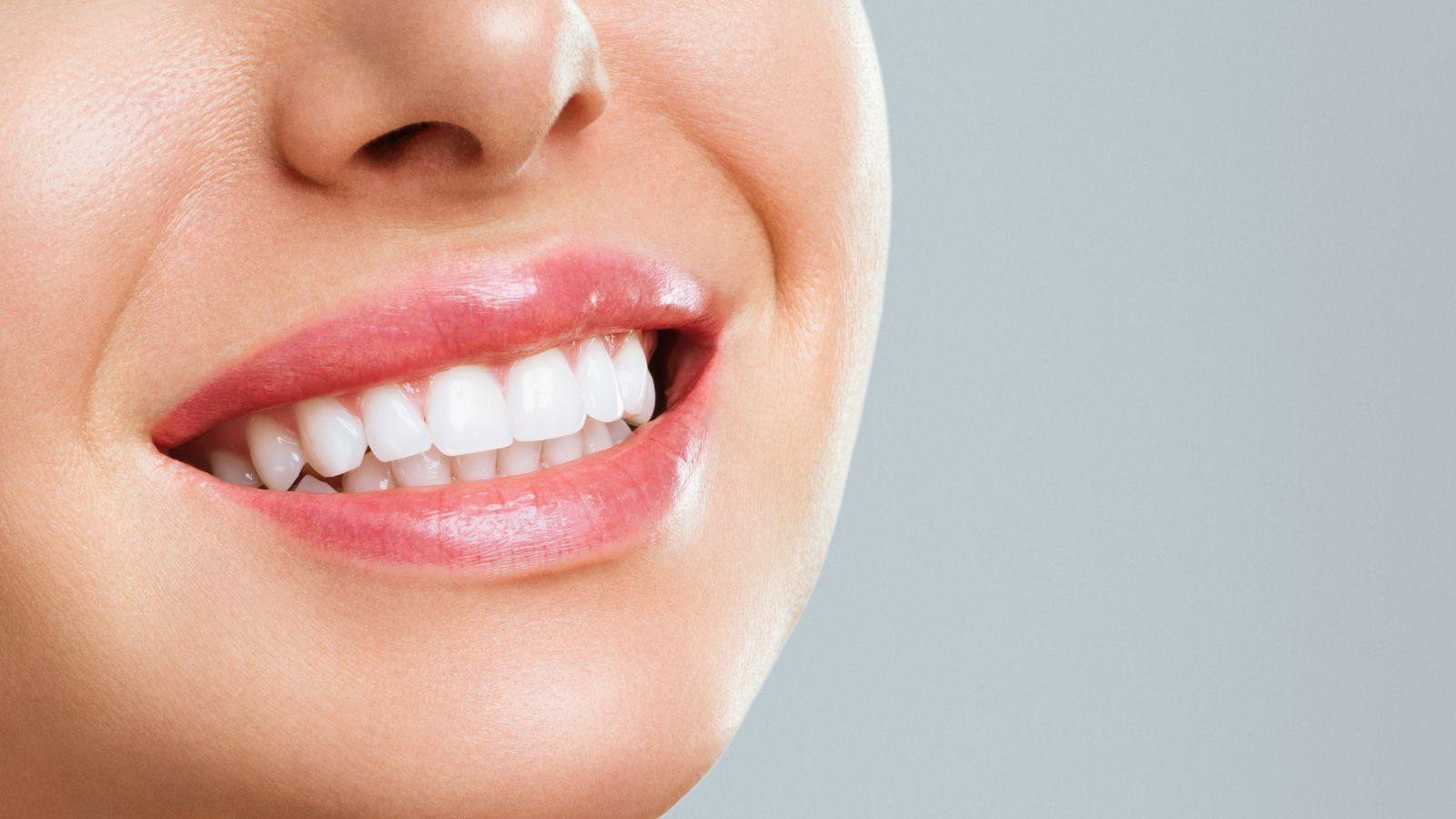 Sbiancamento dentale professionale Caserta