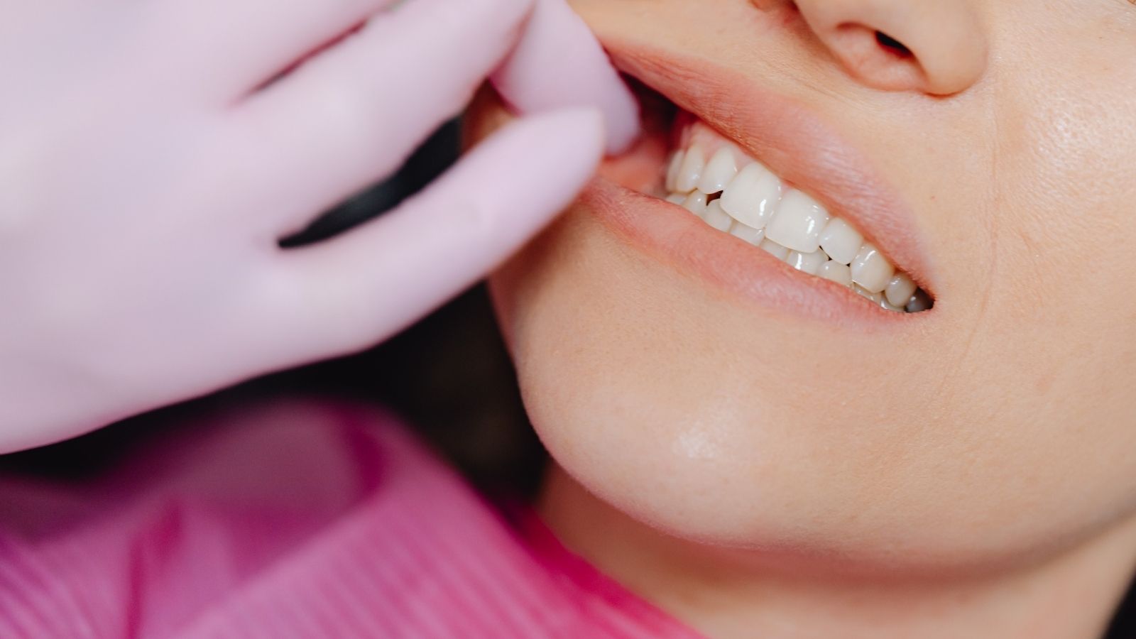 Trattamenti per denti sensibili al Dental Center Caserta