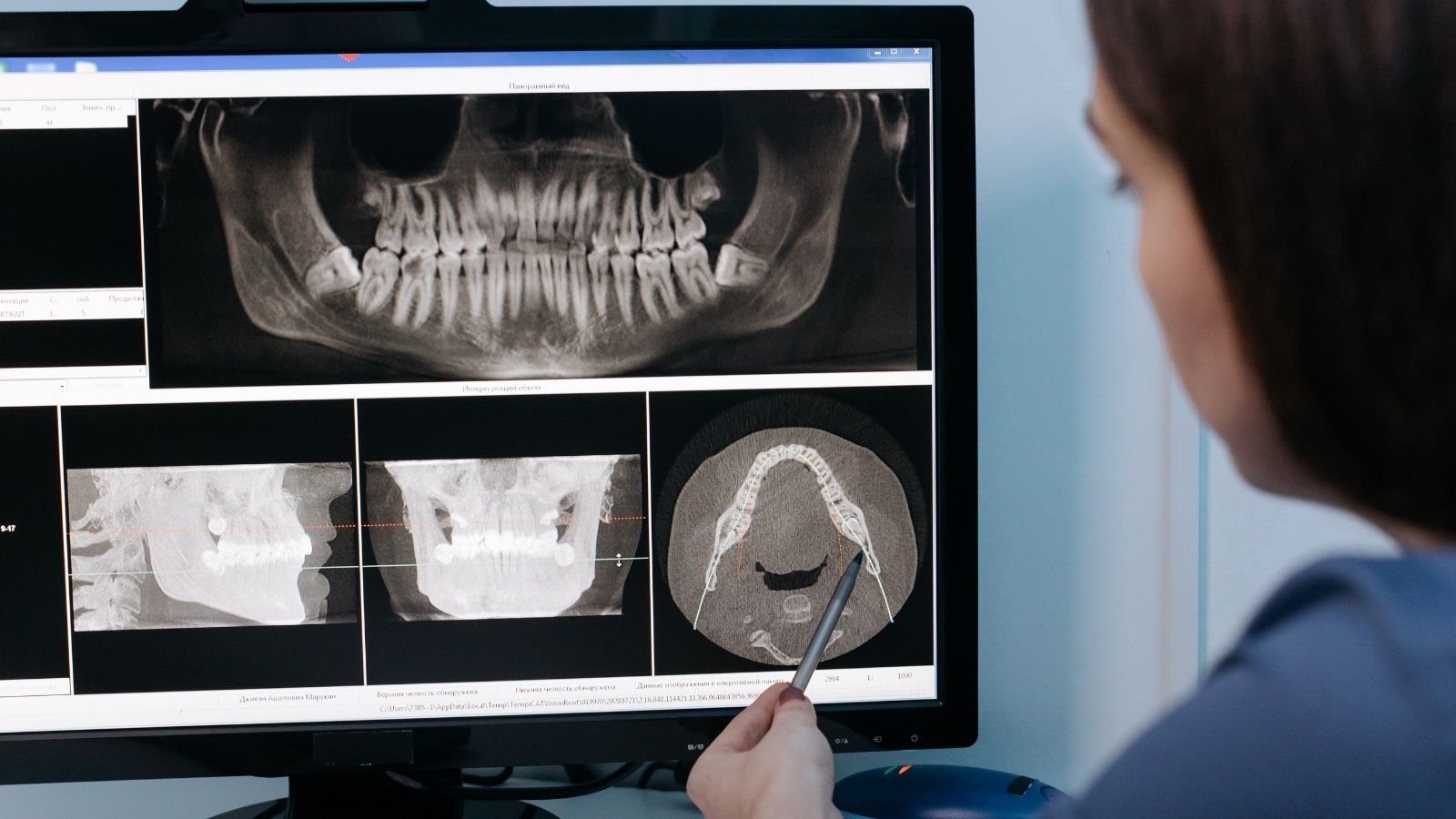 Valutazione pre-implantare e pianificazione digitale a Caserta
