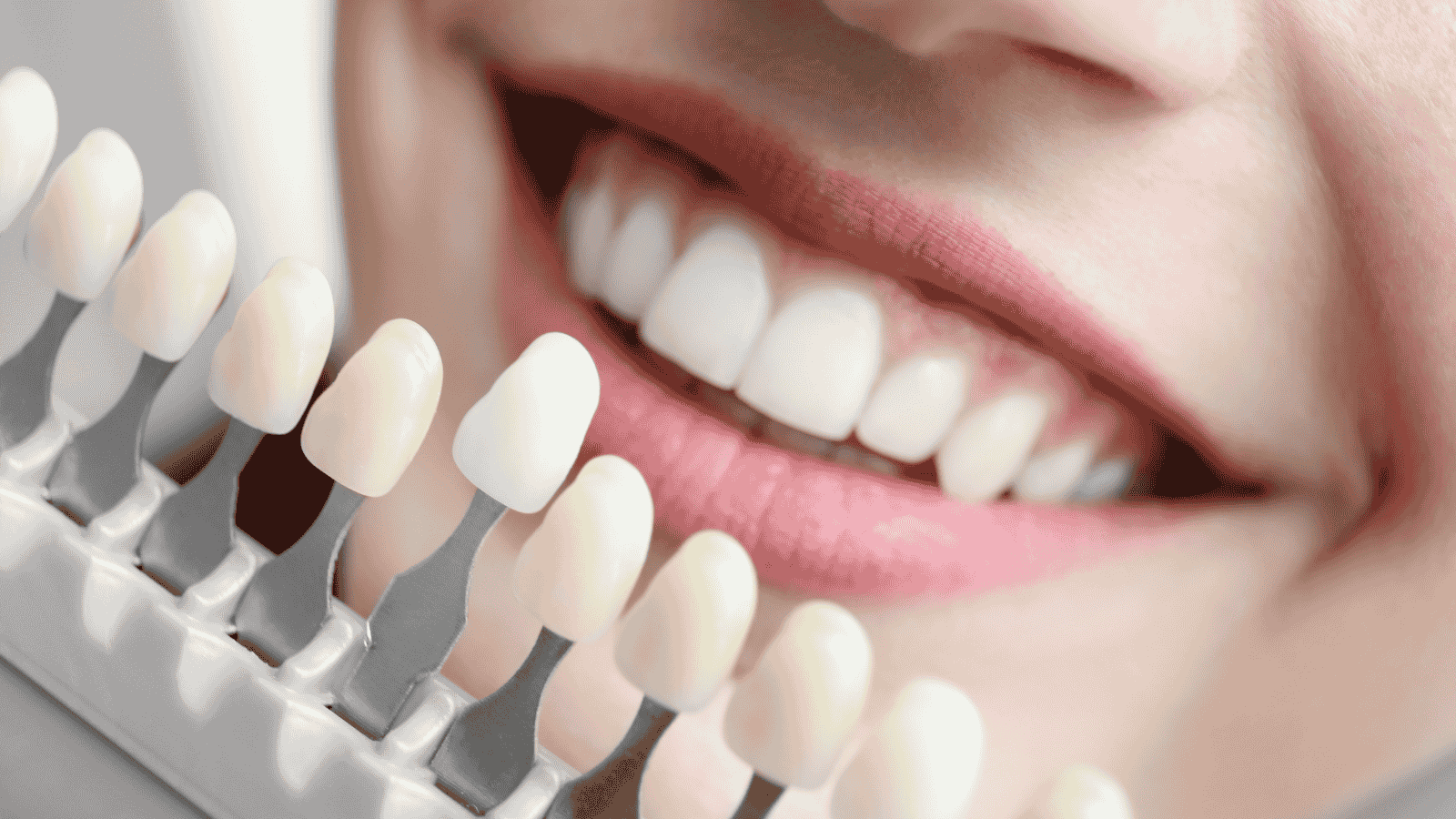 Colore naturale dei denti: da cosa dipende