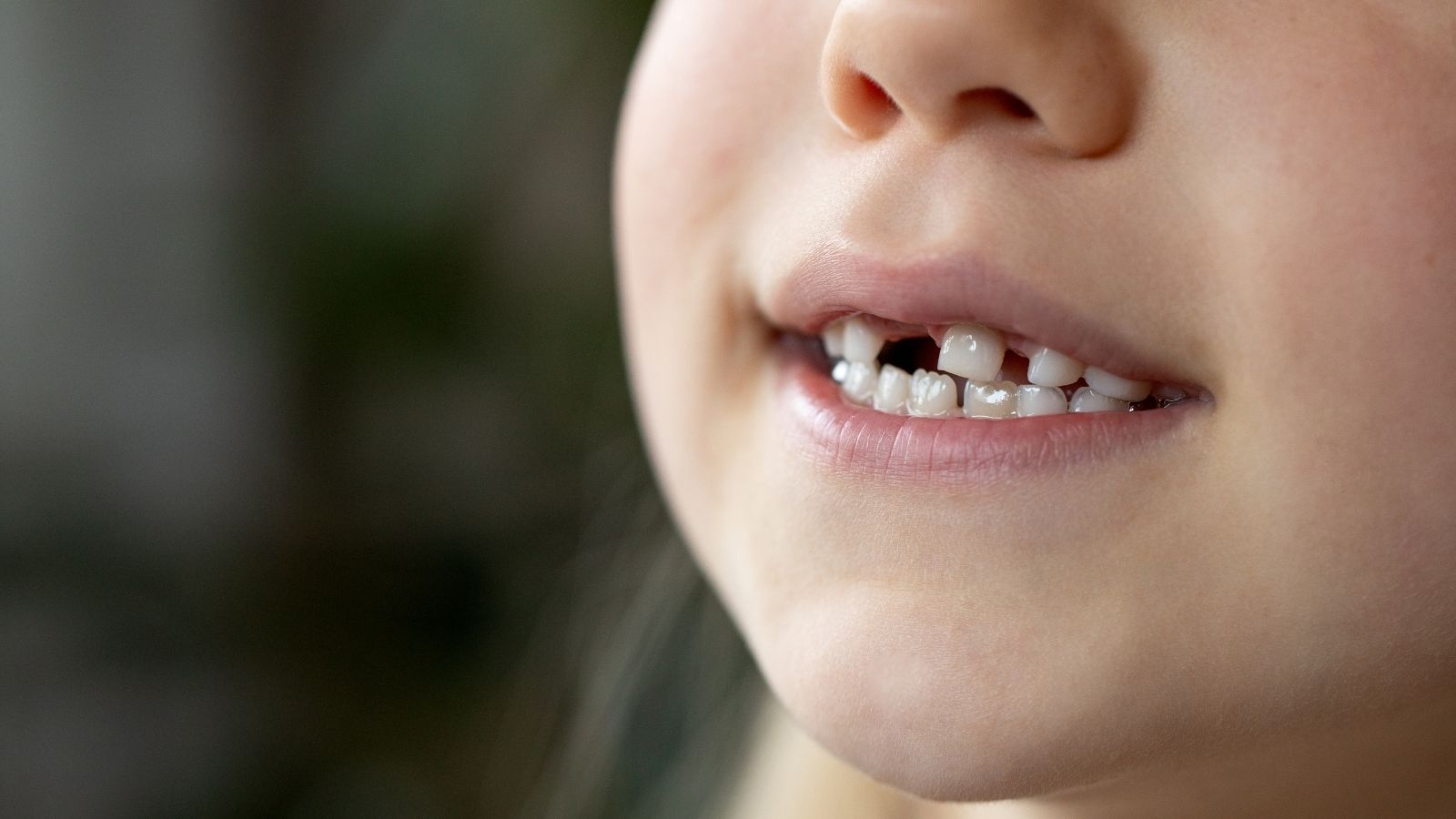 Denti da latte nei bambini: si possono curare?