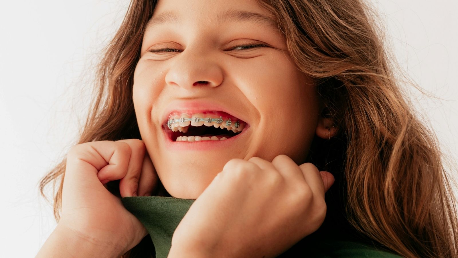 Giovani e apparecchio ai denti: più consapevolezza e meno vergogna