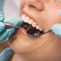 Rientro di settembre: quando fare un controllo dentale