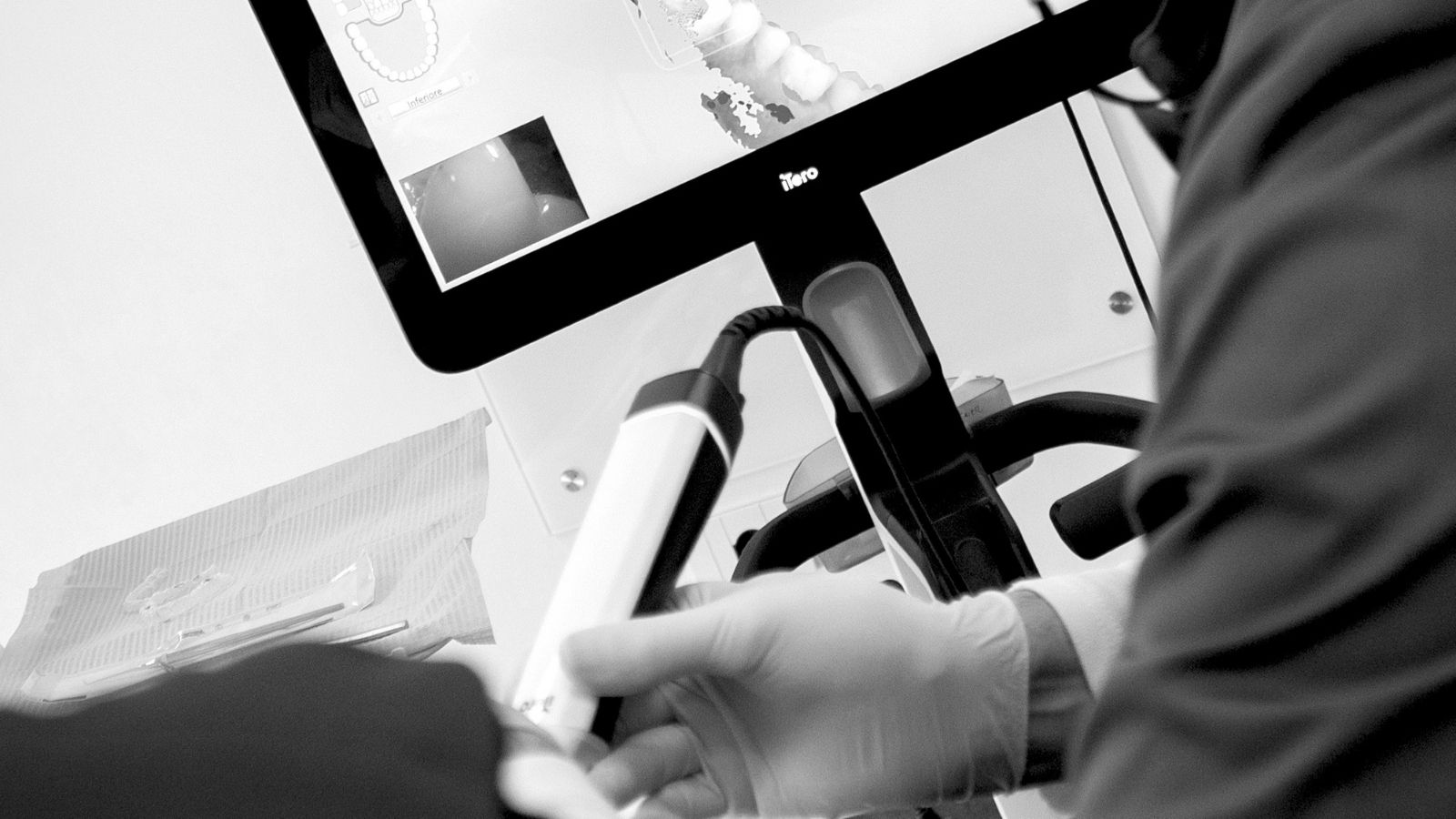 Scansione digitale delle arcate dentali durante una visita ortodontica
