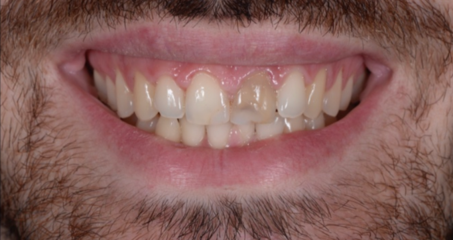 Caso Clinico 3 - prima